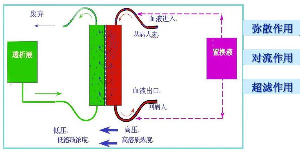 血液透析滤过原理图图片