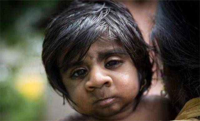 原因令人动容_生活_狼孩_小男孩