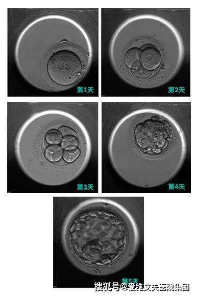在胚胎师眼里移植什么样的胚胎成功率更高