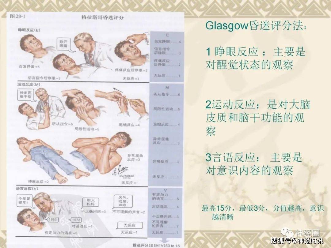 意识障碍的概念机制病因分类