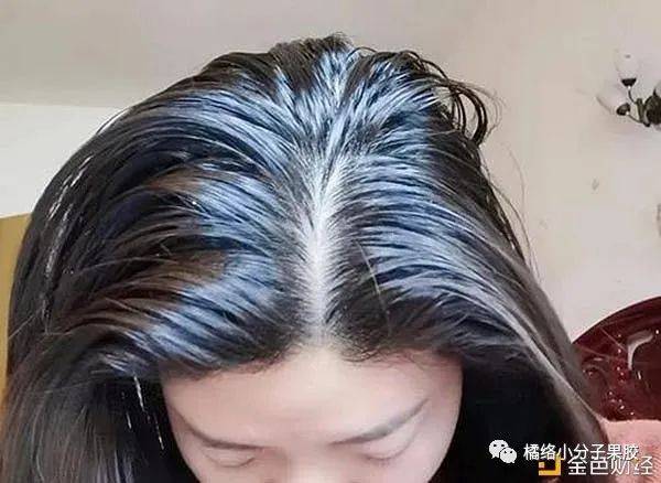 头发爱出油脱发都有可能是体内湿气过重