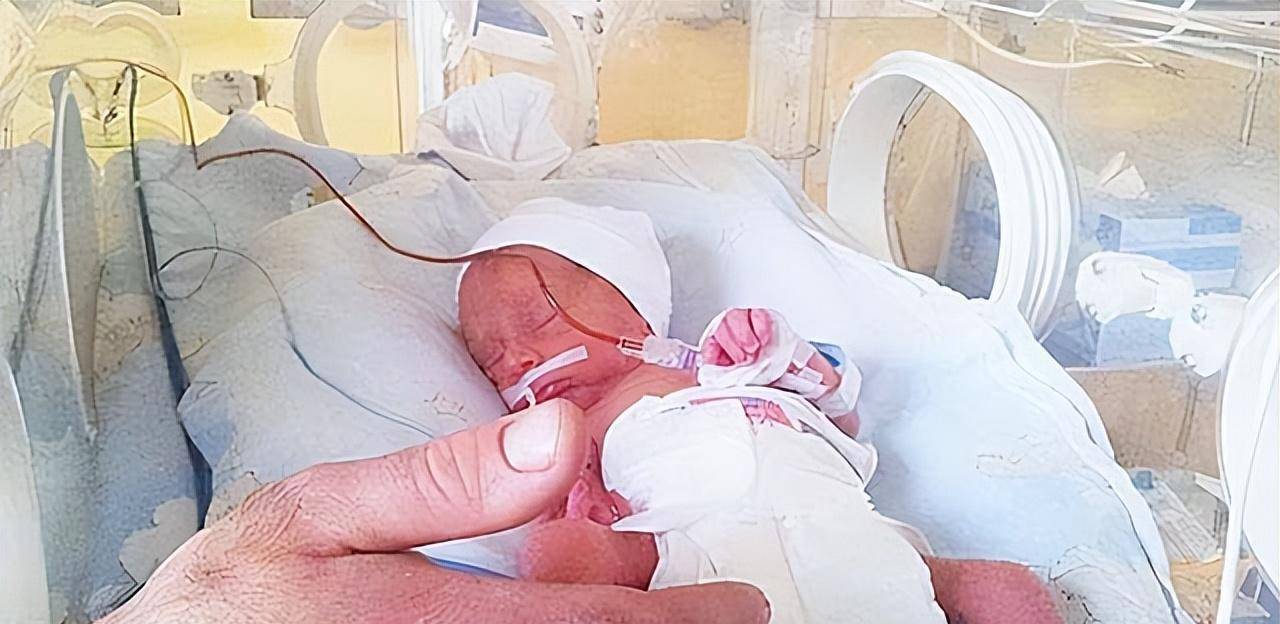 原创2015年山西无肛男婴出生90余天未曾排便近况如何