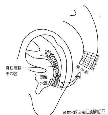 耳朵上的頸椎反射區對治療脖子痠痛,僵硬,發麻,甚至落枕等,都有很好的