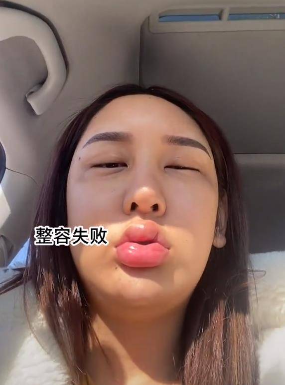 女网红沉迷整容却越整越难看,近照嘴巴肿成香肠嘴,承认整容失败_桃花