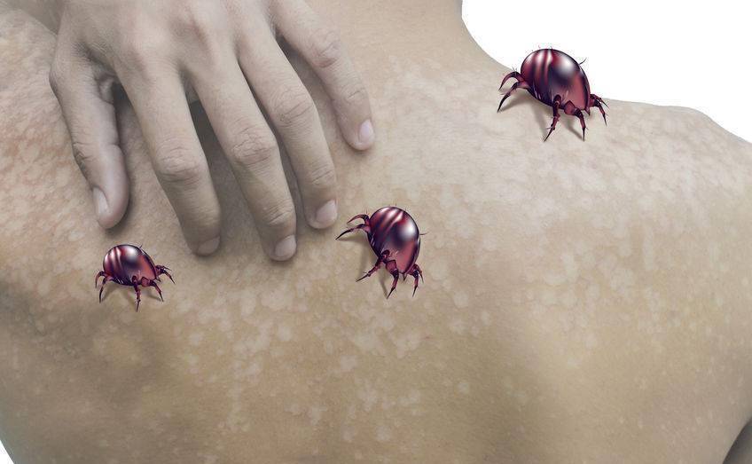 阴雨天潮气重,床上螨虫成窝?三招让它们束手就擒_卧室_皮肤_被子