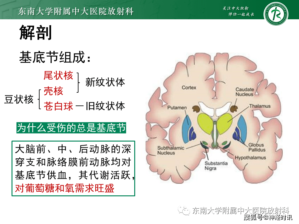 基底节区 放射冠图片