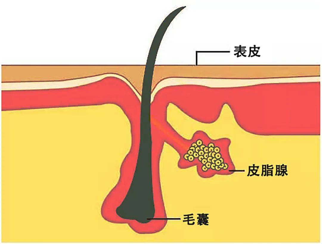 睾丸皮脂腺颗粒图片