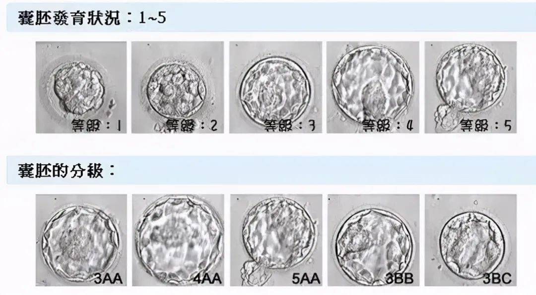 移植20天胚胎大小图片图片