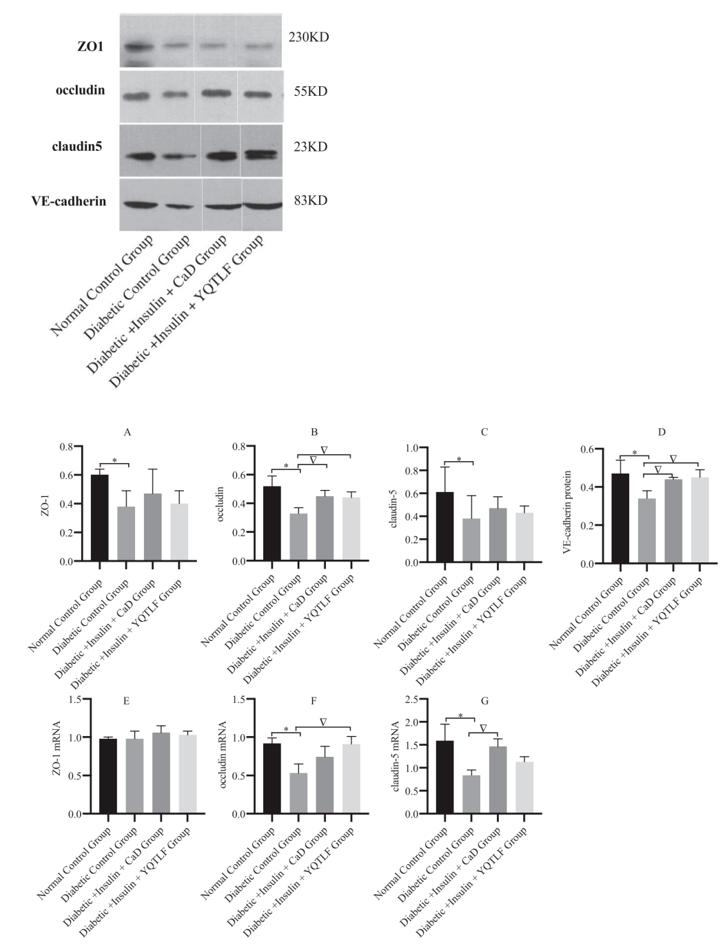 连接蛋白和mrna水平的比较yqtlf治疗12周后显著抑制视网膜prc 2/p38