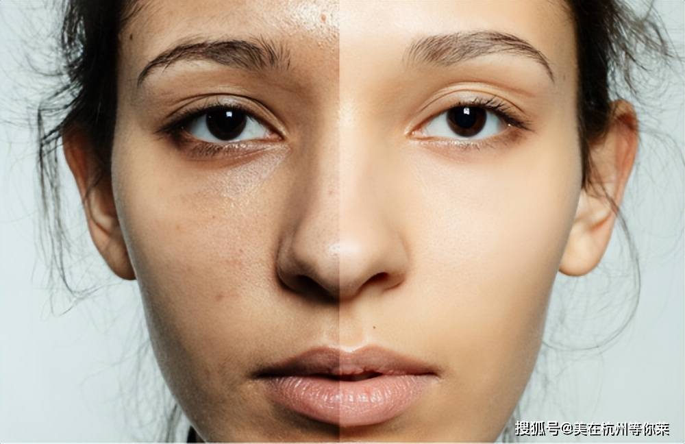 好好的皮肤为啥这么暗淡怎么解决肌肤暗沉