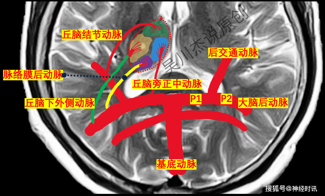图文详解丘脑的血液供应