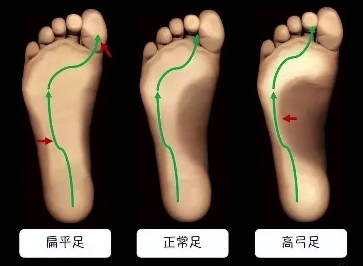 每天承受数百吨的力,却没有被压垮过,人脚有何不同之处?