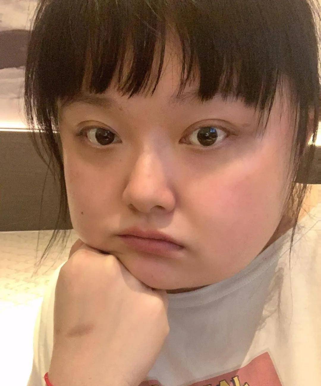 原创230磅细细粒暴食带货体重狂飙曾两度入院网友迟早出事