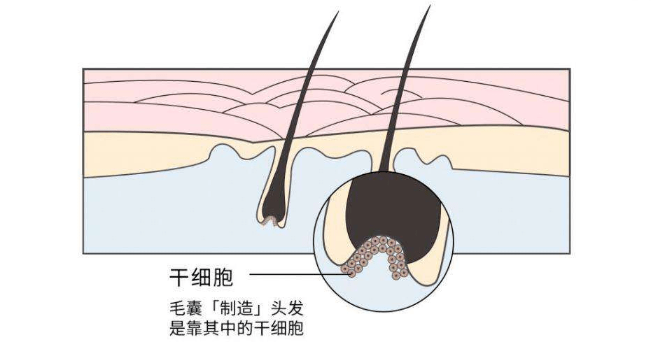 干细胞研发了一种新型非手术式头发修复项目——干细胞激光生发治疗