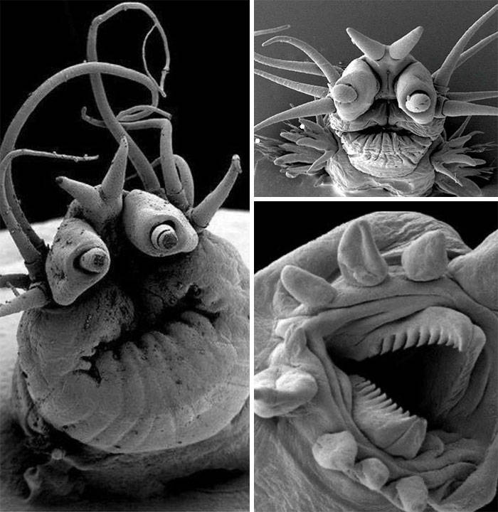 蜗牛的牙齿显微镜图片