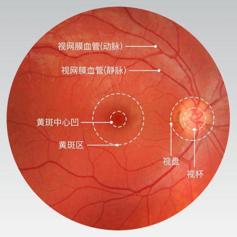 北京爱尔英智谷威院长教您这样预防高血压眼病