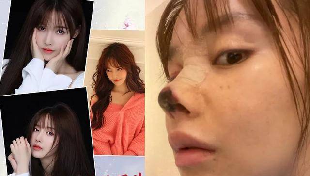 整容失败女星高溜:6年前已是网红脸,拍过大胆写真,学历有水分_照片
