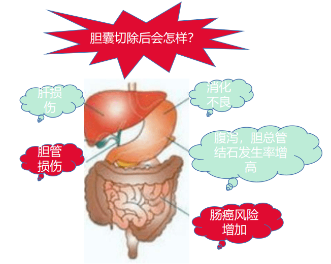 這樣的病人在切除膽囊後不會再出現膽囊炎症狀,生活治療較之前有所