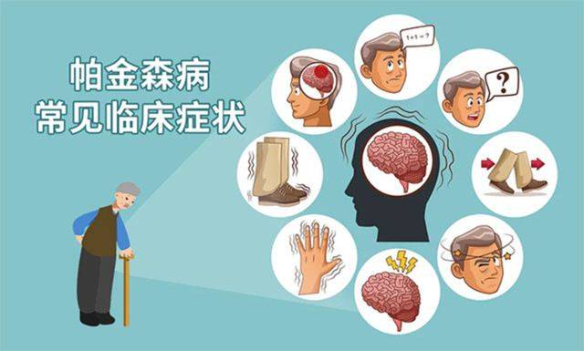 这些症状表示你可能患上帕金森_运动_患者_治疗