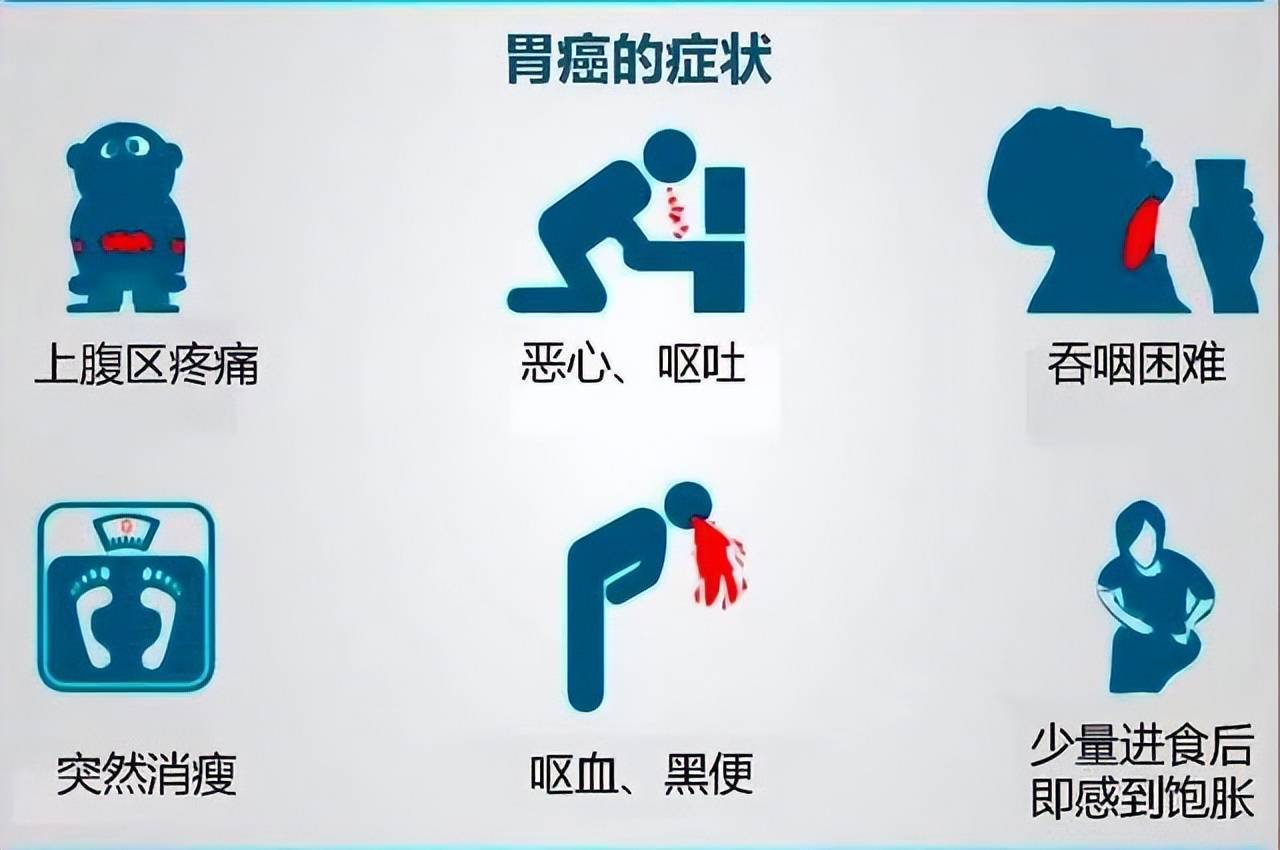 胃癌越来越年轻化,年轻人应该更加注重胃肠健康_检查_我国_身体