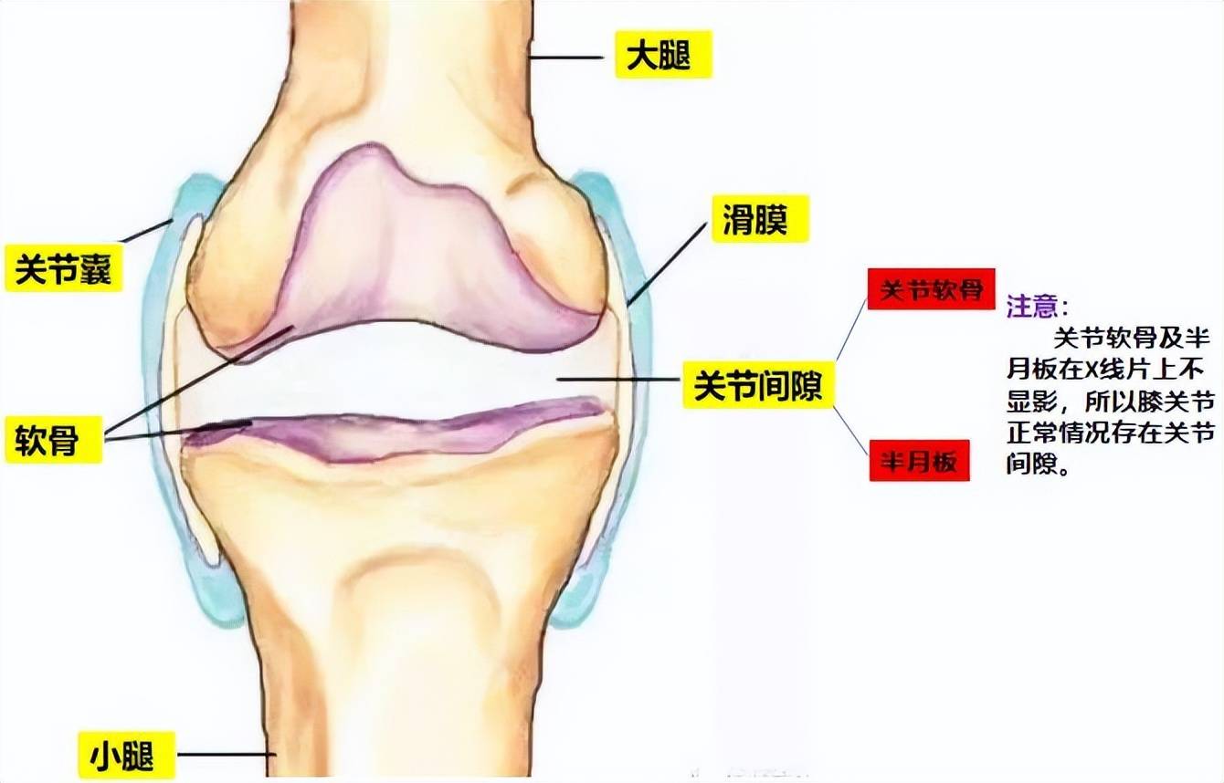 大夫我的膝关节间隙为什么变窄了能救吗