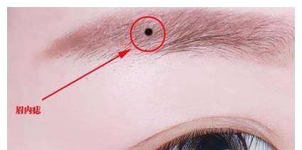 具有吉祥寓意的吉祥痣_事业_是属于_耳珠