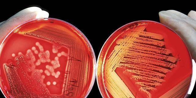 越运动人的寿命就越短 科学家研究发现 氧自由基会破坏细胞结构 生命 变化 科学界