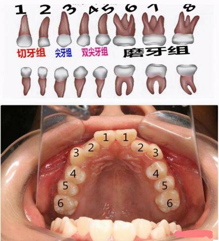 六龄牙:是指儿童生长的第1个恒磨牙,即第1大臼齿(俗称大牙)