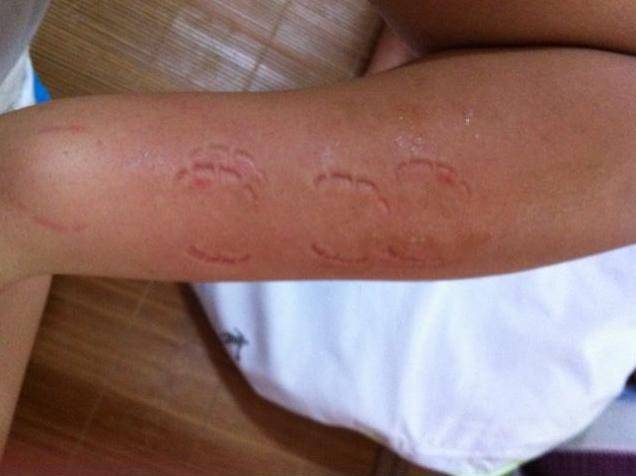 宝宝爱咬人咋办打嘴巴说不可以都没用正确的引导方法要知道