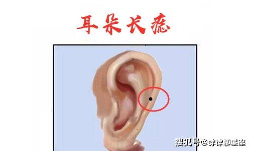 这几处长有活痣极好_生活_位置_个人