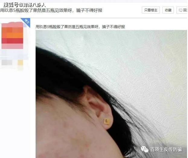 “润凡生物”玖恩化妆品使用后“烂脸” 用户投诉无门(图3)