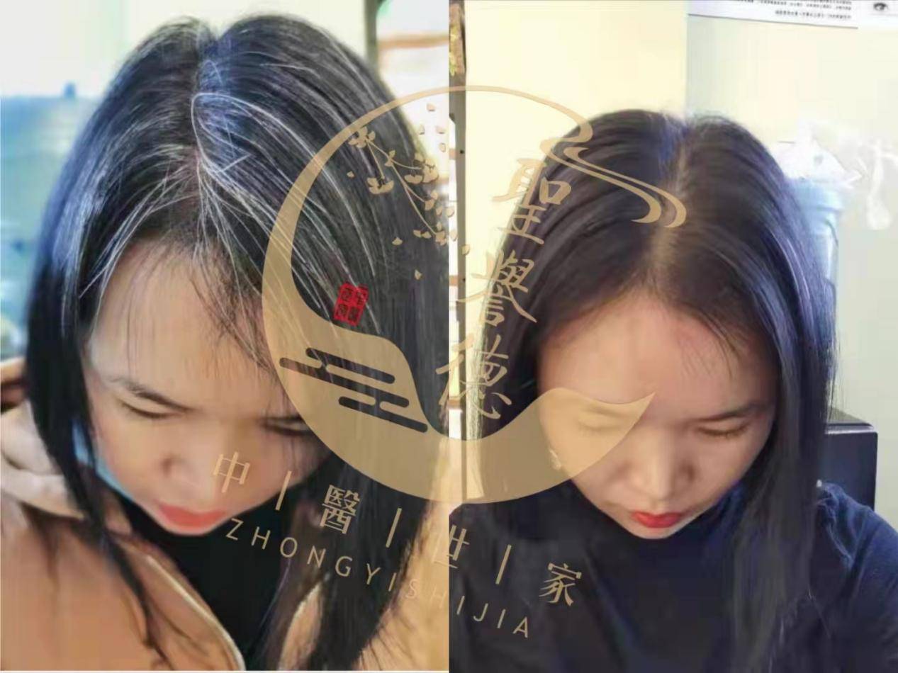 妙手治白发,圣誉德祁医师的神奇之处_王小姐_治疗_问题