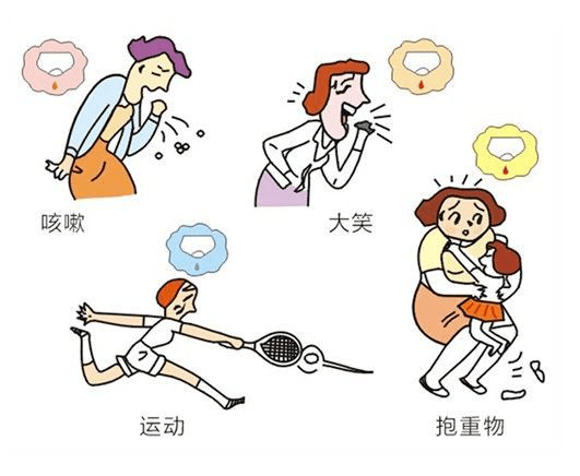 招募100名产后尿失禁患者免费体验盆底康复训练心动不如行动