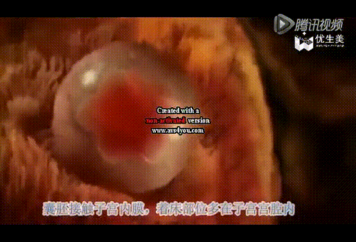 睿梵优孕 | 胚胎着床过程全解析_子宫_内膜_卵子