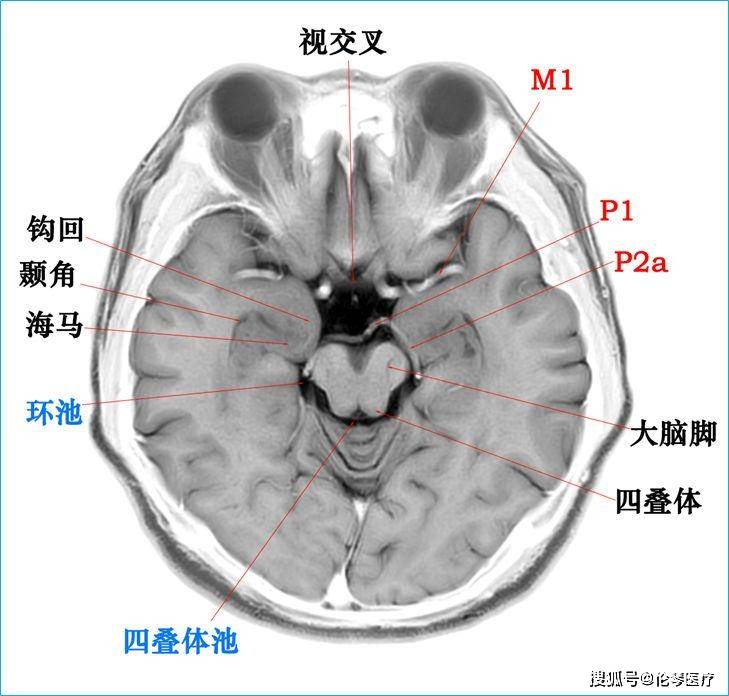 颅脑海马解剖图图片