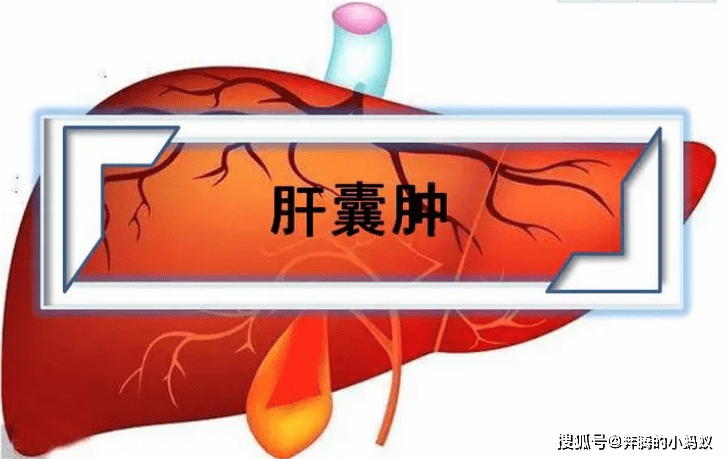 體檢查出肝囊腫怎麼辦醫生送你3個方法看了踏實許多