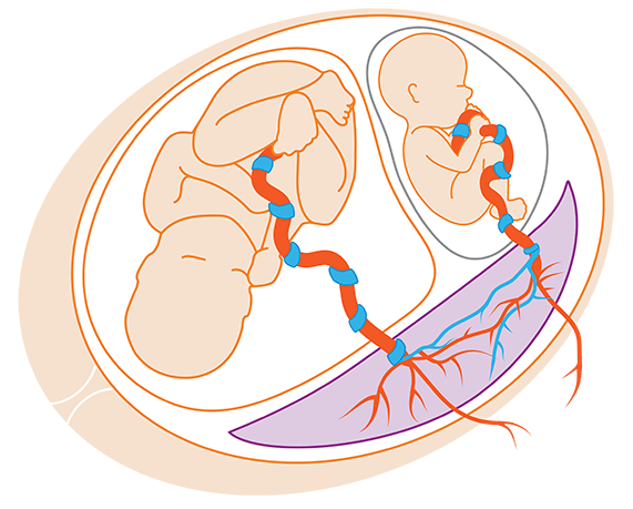 双绒双羊单绒双羊单绒单羊傻傻分不清