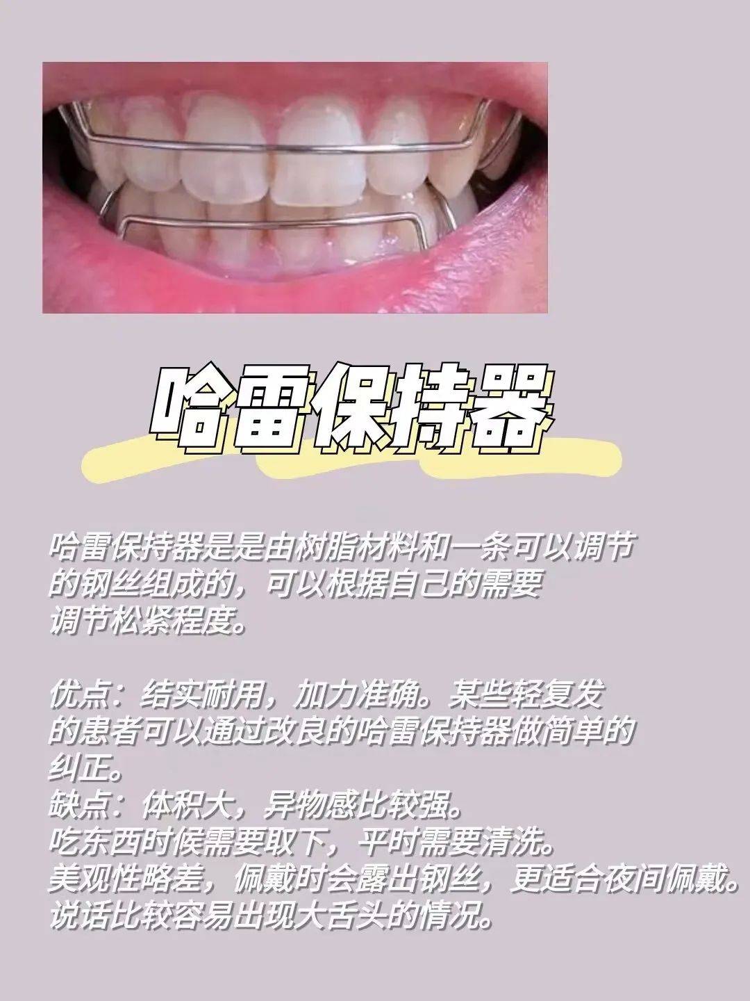 哈雷保持器多少钱一副图片