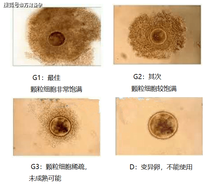 颗粒细胞对卵泡的发育起着重要的作用,卵子的周围附着许多颗粒细胞,它