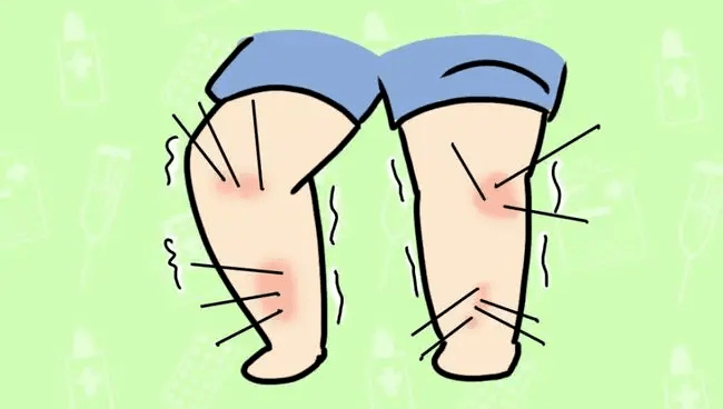 成都华西生长发育研究院孩子腿疼不一定是生长痛更要警惕骨瘤风险