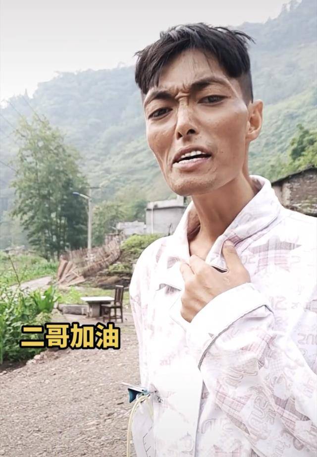 原创一路走！王洪长安34岁的二哥死于肝癌，不到半年就瘦了下来