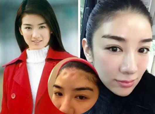 原创9位被整容硅胶脸害惨的好演员蔡明脸肿嘴歪刘晓庆笑不出来