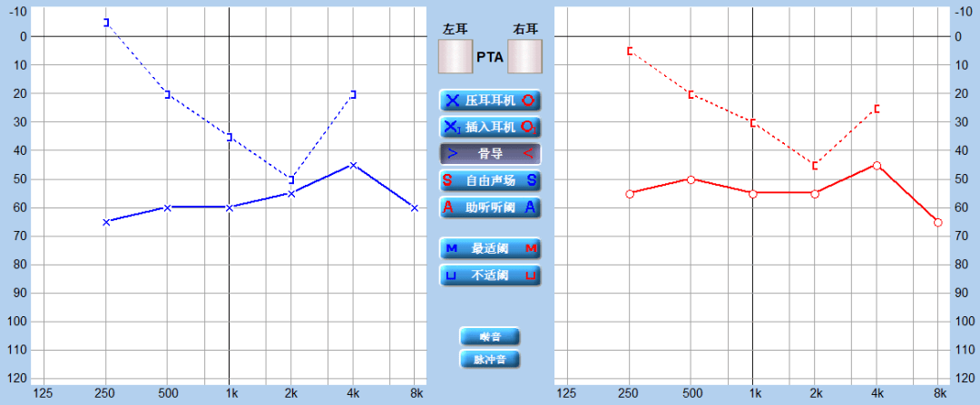 重庆北碚艾声助听器耳硬化症环境越嘈杂听得越清晰