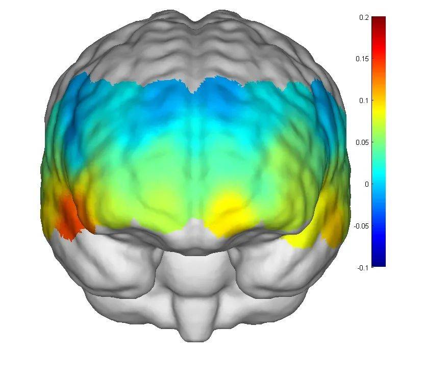慧创近红外助力青少年抑郁症常规检查