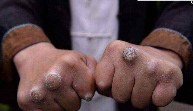 明星中只有四个人手上有拳茧,这三位都是实打实的功夫巨星!