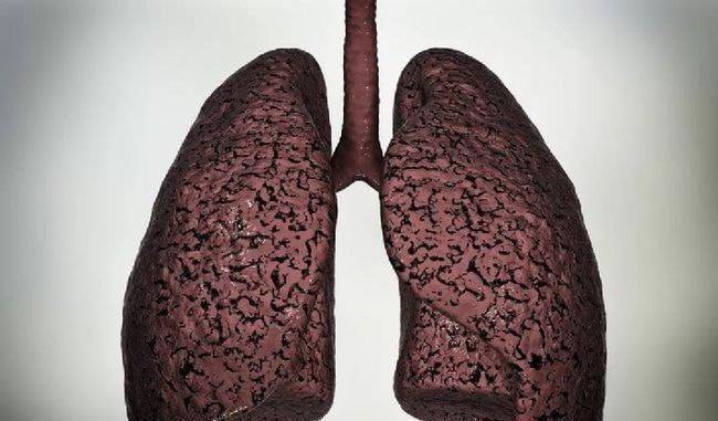 抽烟人的肺部真实照片图片