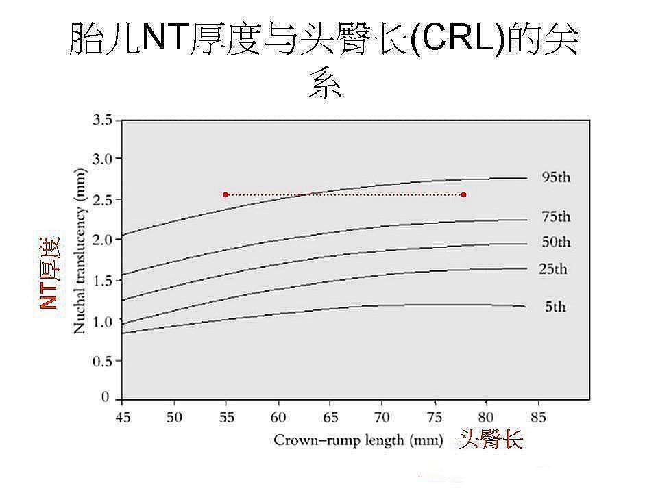 产检单隐藏着很多重要信息,如果孕妇能读懂,检查不白做