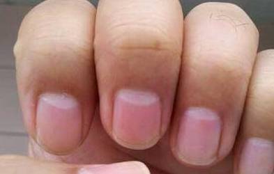 指甲上一个月牙都没有,是身体不健康?今天就告诉你真相!