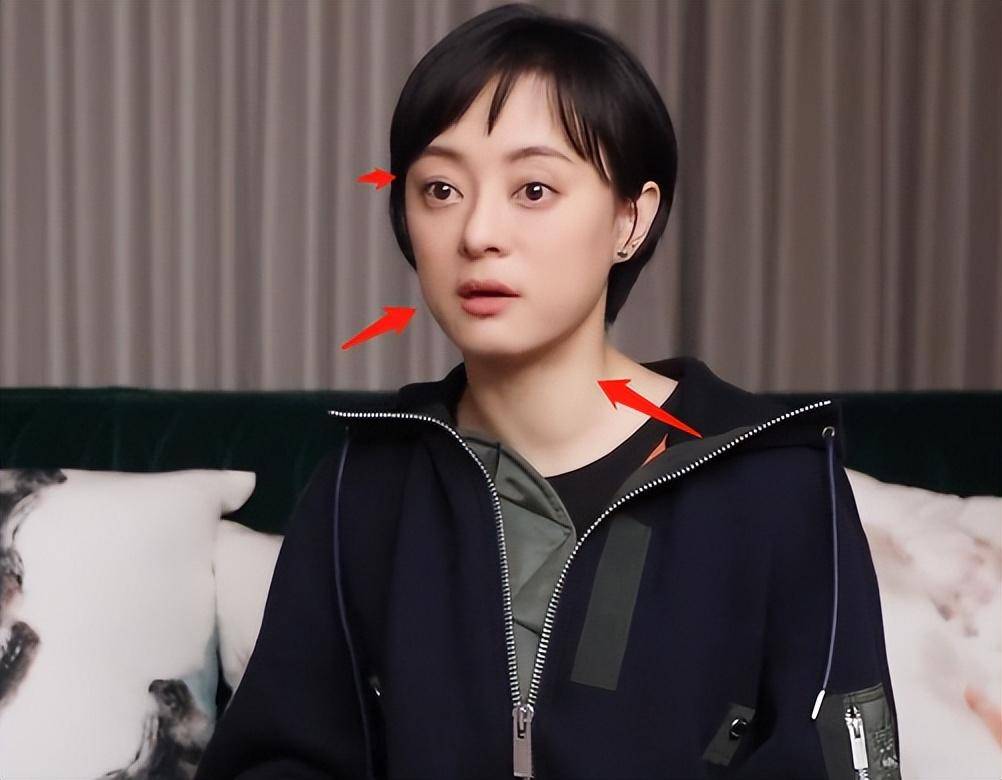 孙俪近况惹争议,腮帮鼓大眼睛外凸疑患甲亢,网友:养生过度导致_孩子