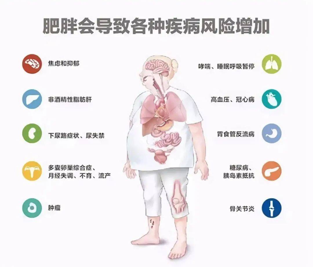 过度肥胖居然会导致呼吸衰竭,你确定还不减肥吗?